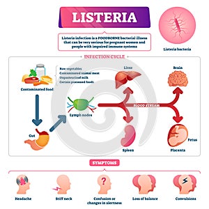 Listeria vector illustration. Labeled educational foodborne bacteria scheme