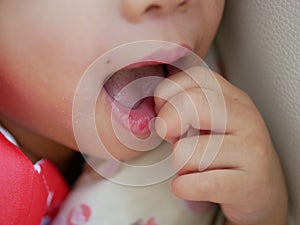 Little baby girl pulling her dry chapped lips - cracked, rough, itchy, and sore from exposure to wind or cold weather