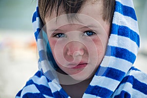 Little boy with atopic dermatitis in a striped bathrobe on the beach bathrobe, photo