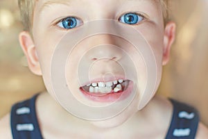 Little boy with blue eyes is showing his wobbly milk tooth