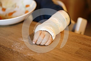 Little boy with a broken wrist at the table. Boy with a plaster on his arm