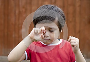 Little boy is having allergy rubbing his eye, Kid scratching his eyes while playing outdoor in summer, Child having allergy itchy photo