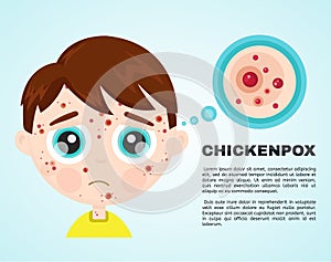 Little boy kid face sick chickenpox