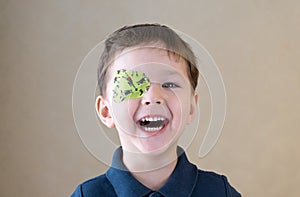 Little boy with okluder on the eye