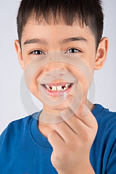 Little boy showing baby teeth toothless close up waiting for new teeth