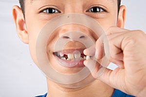 Little boy showing baby teeth toothless close up waiting for new teeth photo