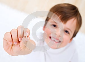 Little boy showing his milk-tooth in his hand