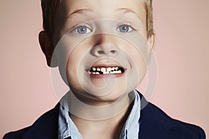 Little boy showing that he lost first milk tooth