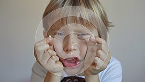 Little boy shows that some of his milk teeth had fallen out. Concept of tooth change in children