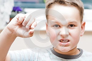 Little boy with a torn front first milk tooth