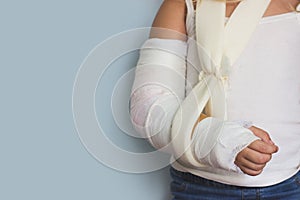 Little girl with broken arm, in plaster
