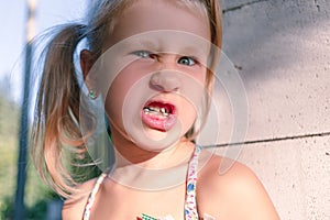 Little girl with crooked teeth and orthodontic appliance