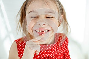 Little girl has no tooth. the child has lost a baby tooth.