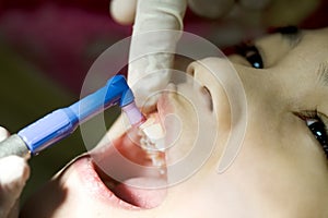 Little girl having teeth cleaned at dental office photo