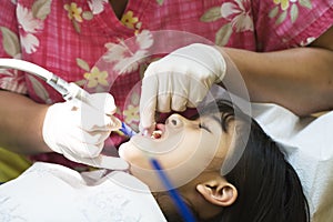 Little girl having teeth cleaned at dentist photo