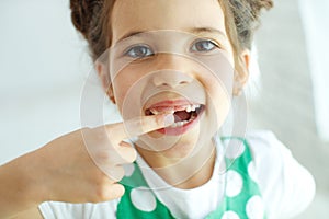 Little girl with no tooth. The child lost a tooth.