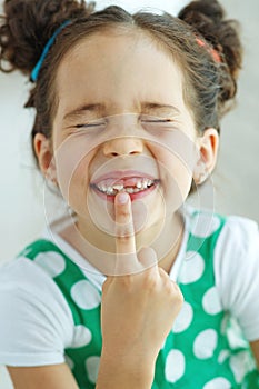 Little girl with no tooth. The child lost a tooth.