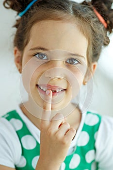 Little girl with no tooth. The child lost a tooth.