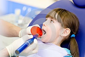 little girl with open mouth receiving dental filling drying procedure.
