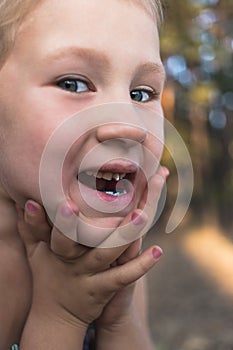 Little girl with orthodontics appliance and crooked teeth. Wobbly tooth