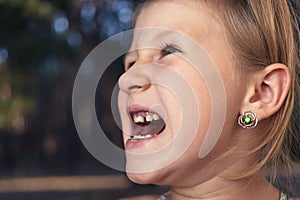 Little girl with orthodontics appliance and crooked teeth. Wobbly tooth