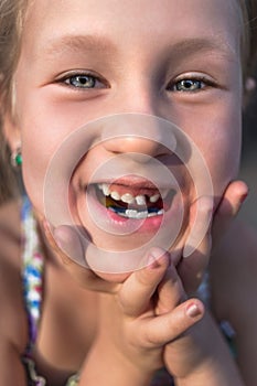 Little girl with orthodontics appliance and crooked teeth. Wobbly tooth