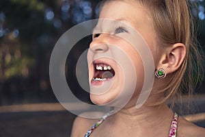Little girl with orthodontics appliance and crooked teeth. Wobbly tooth