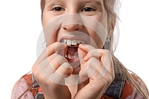 Little girl with orthodontics appliance isolated on white background