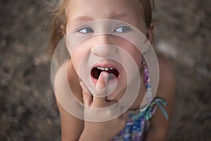 Little girl points the finger at a wobbly baby tooth