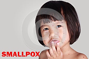 Little Girl With Smallpox photo