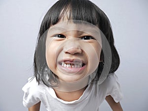 Little Girl Smiling Shows He Decay Tooth