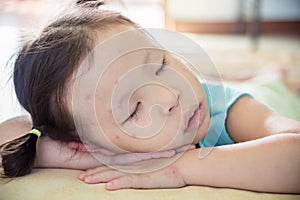 Little girl with spot on face sleeping after get sick