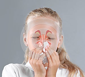 Little girl suffering from runny nose as allergy symptom. Sinuses illustration