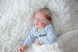 Little newborn baby sleeping, baby with scin rash photo