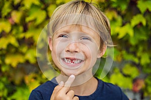 Little smiling child boy hand pointing his first baby milk or temporary tooth fall out