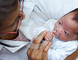 Little trooper. A female nurse holding a baby girl who has a cleft palate.