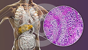 Liver with biliary cirrhosis