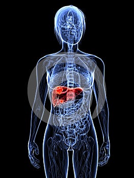 Liver cancer