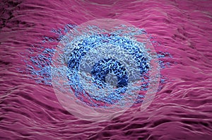 Liver cancer hepatoma blue side view 3d illustration photo