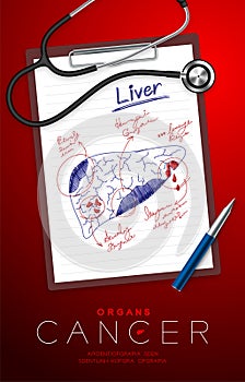 Liver Cancer and infection, Doctor writing and hand sketch drawing on paper chart with pad, pen and stethoscope, Medical Science