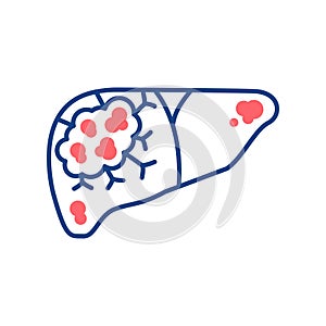Liver cancer line color icon. Human organ concept. Malignant neoplasm. Sign for web page, mobile app, button, logo. Vector photo