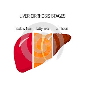 Liver cirrhosis concept photo