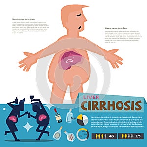 Liver Cirrhosis. infographic - photo