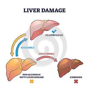 Liver damage stages with reversible and irreversible disease outline concept photo