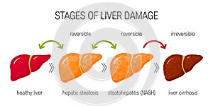 Liver damage vector concept
