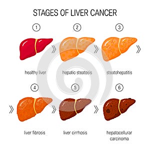 Liver damage vector concept photo