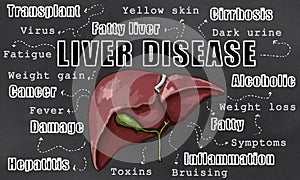 Liver Disease Illustration