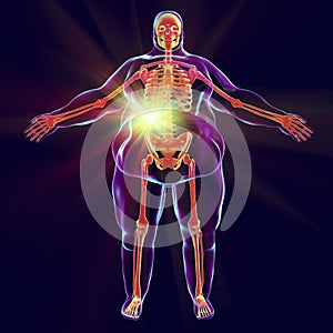 Liver disease in obesity