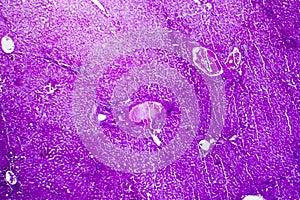 Liver edema, light micrograph