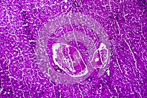Liver edema, light micrograph